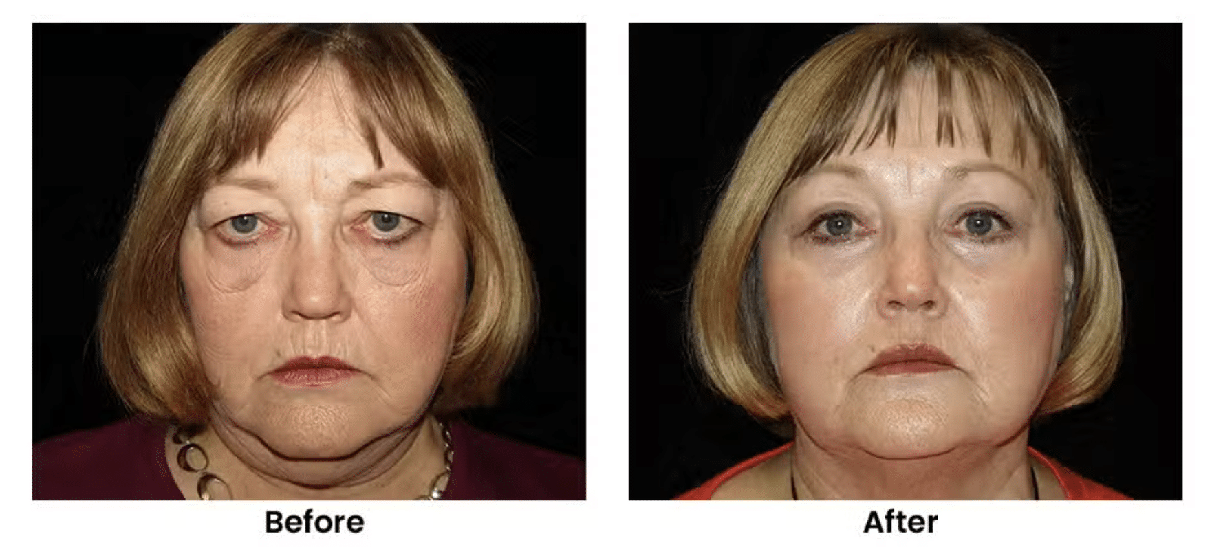 Screenshot 2026-02-12 at 1.10.47 PM Cosmetic Surgery in St. George, UT