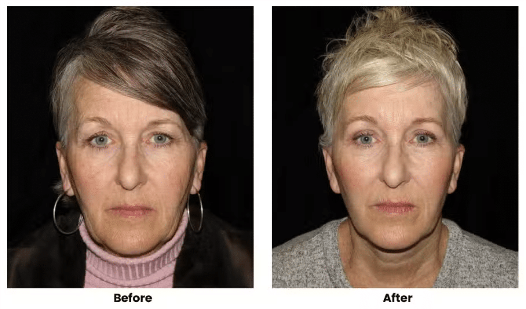 Screenshot 2026-02-12 at 1.11.18 PM Cosmetic Surgery in St. George, UT