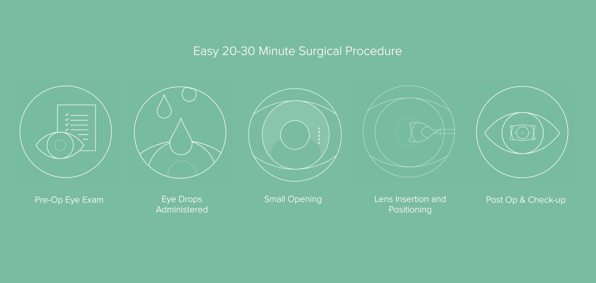 EVO ICL Surgical Procedure St George UT